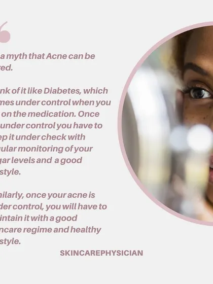 It's a myth that acne can be cured permanently. I encourage patients to think of it like a chronic condition that can be controlled with medication and maintained with a good skincare regimen and healthy lifestyle.