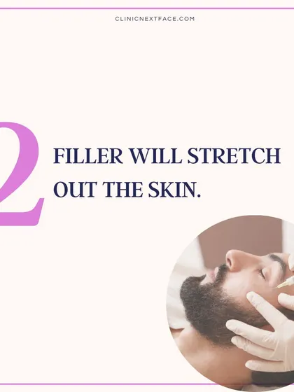 Myth 2: Filler will stretch out the skin. Fact: With an experienced provider, dermal filler should not stretch the skin. Your skin's laxity will remain unchanged, and some fillers can even boost collagen.