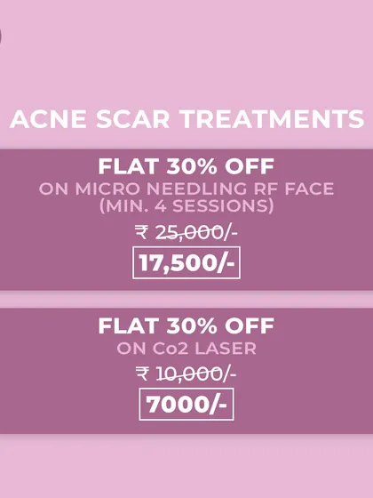 We provide tailored packages for acne scar treatments like Microneedling RF and CO2 Laser. These multi-session plans ensure consistent progress towards smoother, clearer skin.
