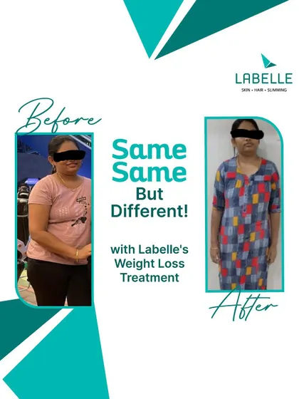 Same person, but with a renewed sense of health and confidence. Our advanced weight loss treatments create noticeable changes that go beyond the scale.
