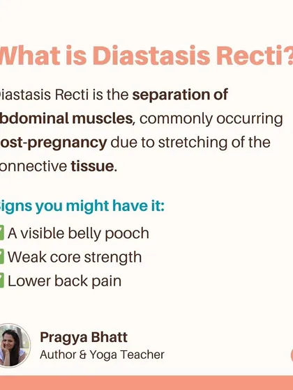 What is Diastasis Recti? It's the separation of abdominal muscles, and common signs include a visible belly pooch, weak core strength, and lower back pain. Yoga can help heal this condition naturally.