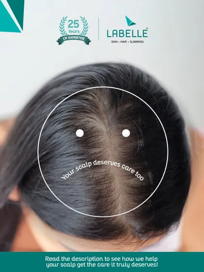 Healthy hair begins with a healthy scalp. We focus on treating the root cause of hair issues, not just the symptoms, because we believe your scalp deserves dedicated care for long-lasting hair health.