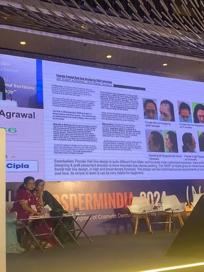 Presenting my case study on female hair transplant at a major aesthetic conference. It is crucial to understand that female pattern hair loss is different and requires a unique, nuanced approach to restoration.