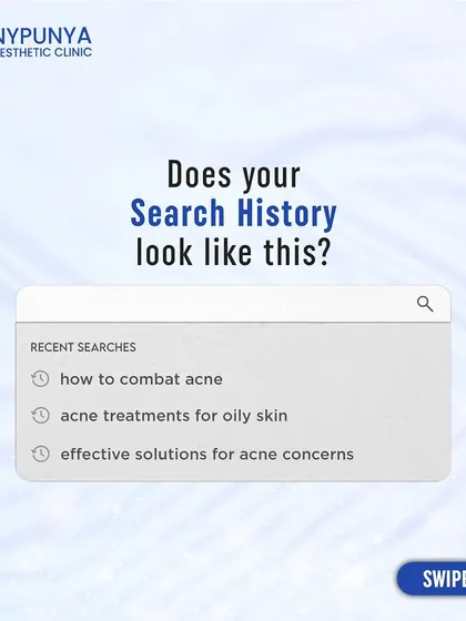 Does your search history look like this? If you're constantly looking for acne solutions online, it's time to consult an expert. I can provide a clear diagnosis and an effective treatment plan.