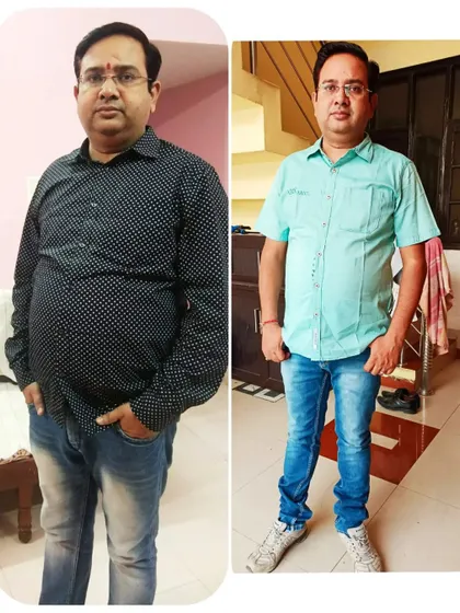 This is Pankaj Sharma, who successfully managed his cholesterol, sugar, and liver issues through my diet program. This before and after photo shows the significant weight loss that accompanied his internal health improvements.