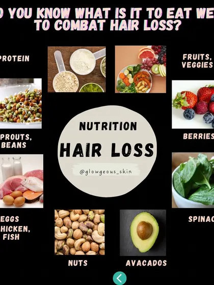 **A visual guide to the best foods to combat hair loss.** This infographic shows key nutritional categories including protein, fruits, vegetables, berries, spinach, avocados, nuts, eggs, and sprouts. Eating a balanced diet is your first line of defense.