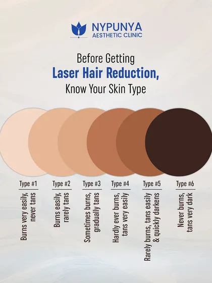Before getting laser hair reduction, it's crucial to know your skin type. The Fitzpatrick scale helps us determine which laser technology will be the safest and most effective for your complexion, ensuring optimal results without complications.