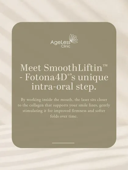 This graphic explains the unique intra-oral step of the Fotona 4D treatment, called SmoothLiftin. By working inside the mouth, the laser gets closer to the collagen supporting your smile lines, gently stimulating it for improved firmness and softer folds.