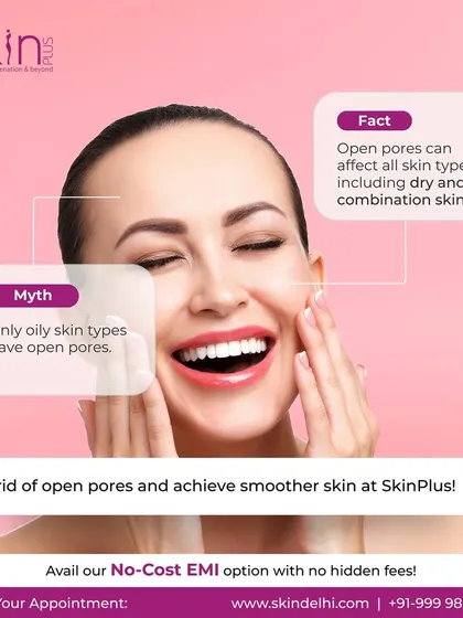 A myth-busting graphic clarifying that open pores can affect all skin types, not just oily skin. It positions my clinic as the solution for achieving smoother skin.