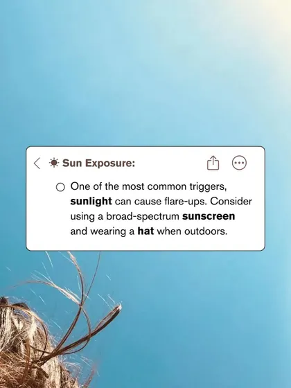 Sun exposure is one of the most common triggers for Rosacea flare-ups. I always advise my patients to use a broad-spectrum sunscreen and wear a hat to protect their sensitive skin.