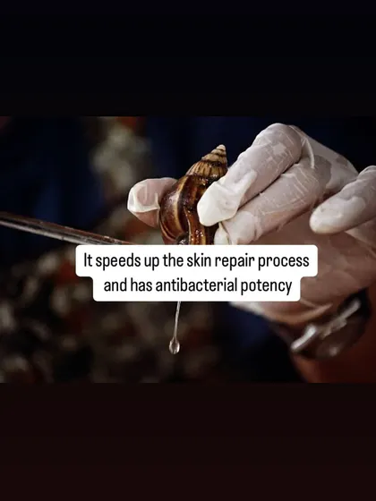 With its antibacterial properties and ability to speed up the skin repair process, snail mucin can be beneficial for healing and calming irritated skin.