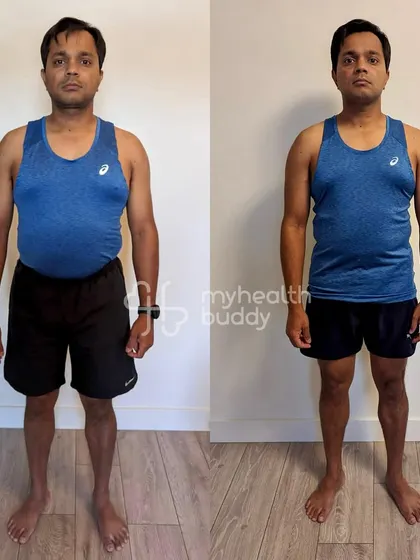 This client lost 5 kgs and significant body fat in 3 months, even with a hectic work travel schedule. He stayed committed to his vegetarian meal plan and hotel gym workouts.