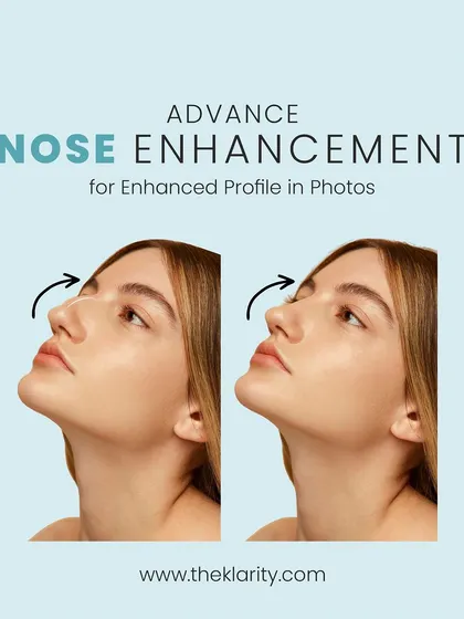 A well-proportioned nose can significantly enhance your facial profile and overall harmony. Using dermal fillers, I can perform non-surgical nose sculpting to correct minor bumps, lift the tip, or create a straighter bridge, giving you a more refined look in photos and in person.