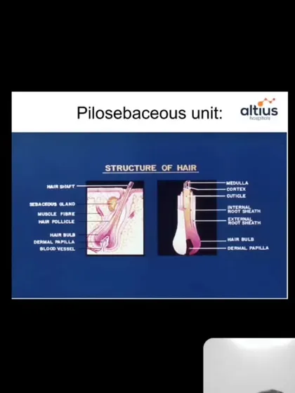 Understanding the science of hair is the first step to effective treatment. This slide from one of my educational webinars illustrates the pilosebaceous unit, the complex structure responsible for hair growth, which is central to our hair restoration therapies.