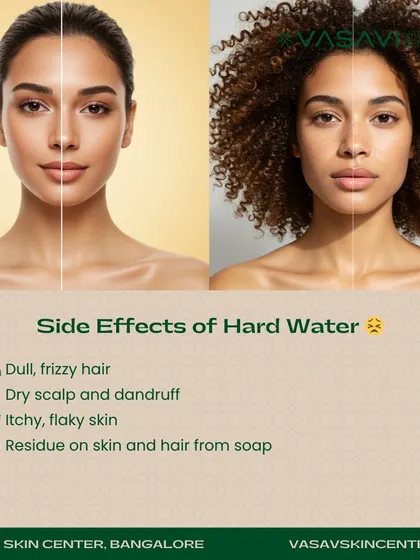 The side effects of washing with hard water are clear. It can lead to dull, frizzy hair, a dry and flaky scalp, and itchy skin. The mineral residue can also prevent soaps and shampoos from rinsing away completely.