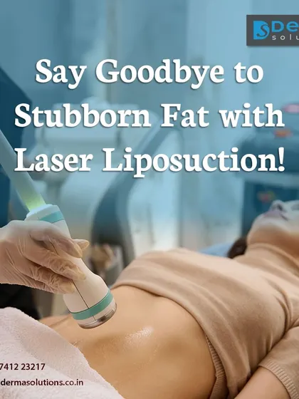This image shows a Laser Liposuction treatment in progress on the abdominal area. I use focused laser energy to gently liquefy fat cells, allowing for precise body sculpting and contouring. This minimally invasive technique is excellent for achieving a more defined and toned physique.