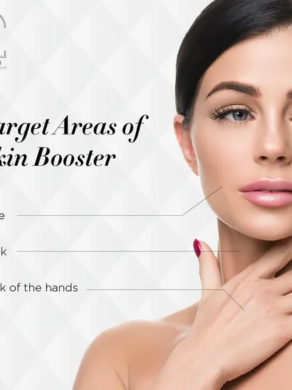 This graphic shows the target areas for Skin Boosters, including the face, neck, and back of the hands, to restore a youthful appearance.