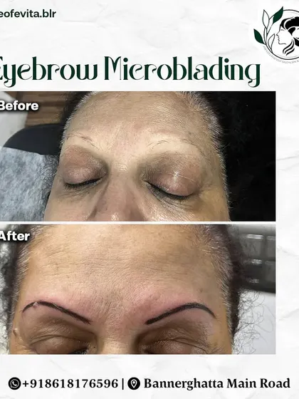 This shows how I can create brows where there were none. Using a precise outline and careful Microblading, I built a completely new set of brows for this client.