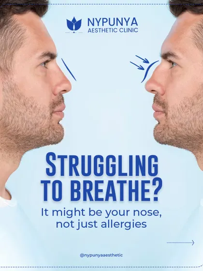 If you are struggling to breathe, it might be your nose's internal structure, not just allergies. A septoplasty, often done with rhinoplasty, can correct a deviated septum.