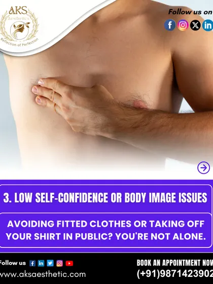 If you find yourself avoiding fitted clothes or feeling self-conscious about your chest, you are not alone. These body image issues are a common reason many men seek gynecomastia correction.