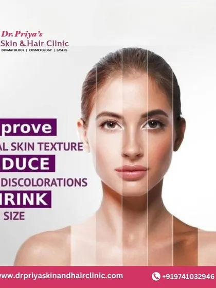 My treatments are designed to improve facial skin texture, reduce skin discolorations, and shrink pore size. A comprehensive consultation allows me to create a plan tailored to your specific goals.