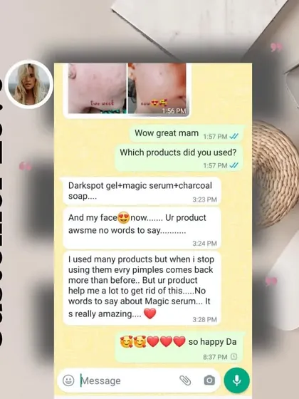 This customer used my Darkspot Gel, Magic Serum, and Charcoal soap and says her face is "awsme no words to say."