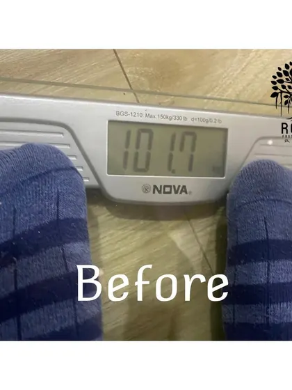Before: The start of our Summer Weight Loss Programme for a client weighing 101.7 kgs. The goal was set for a healthy, natural transformation.