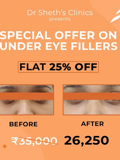 Under-eye fillers can dramatically reduce the appearance of dark circles and hollowness. This before and after image shows how we restore volume to the tear trough area, creating a brighter, more rested, and rejuvenated look.