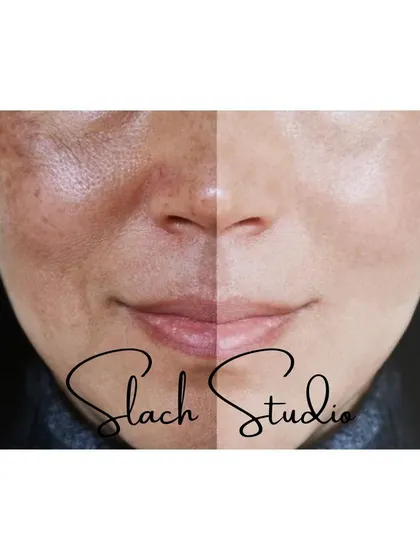 This split-face image provides a direct comparison, highlighting the dramatic difference in skin tone and texture.