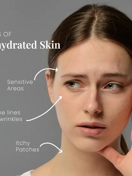 This diagram shows the common signs of dehydrated skin, which is a lack of water, not oil. It can manifest as fine lines, itchy patches, and sensitive areas.