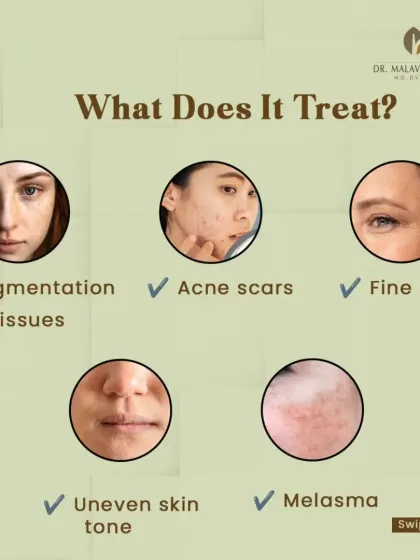 Laser toning is a versatile treatment that addresses a range of concerns. It is effective for pigmentation issues, acne scars, fine lines, uneven skin tone, and even melasma.