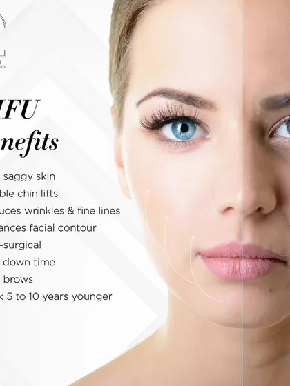 A comprehensive list of HIFU benefits, from lifting saggy skin and reducing wrinkles to enhancing facial contour for a look that is 5 to 10 years younger.
