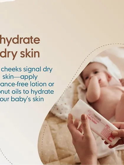 Cooler, drier air can lead to dry skin and red cheeks in babies. We recommend using a fragrance-free lotion or natural coconut oil to keep your baby's delicate skin hydrated and protected during changing seasons.
