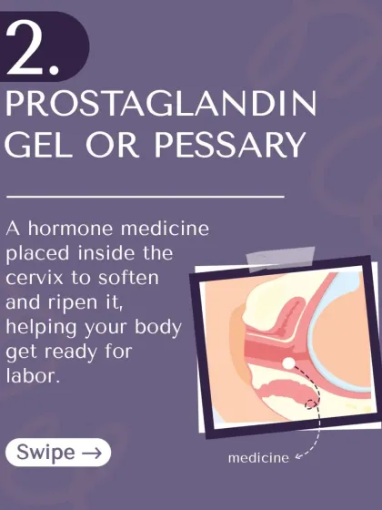 Method 2: Prostaglandin gel or pessary. This is a hormone medicine placed near the cervix to help it soften and ripen.