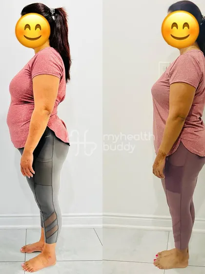 Side view of my client's 8 kg transformation. Notice the significant inch loss and improved posture, which are just as important as the number on the scale.