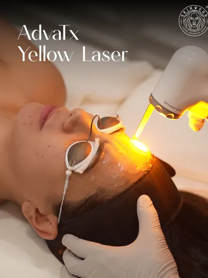 The ADVATx Yellow Laser in action. This US FDA-approved technology is my go-to for tackling redness, pigmentation, and providing an overall collagen boost with no downtime.