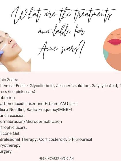 I offer a wide range of treatments for both atrophic (depressed) and hypertrophic (raised) acne scars. This list outlines various options, from chemical peels and microneedling to surgical procedures, ensuring a customized approach.