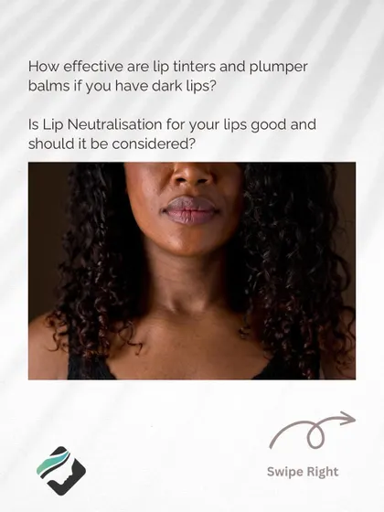 For those with dark lips who find topical products ineffective, I offer advanced treatments like lip neutralization to achieve a more even and desirable lip tone.