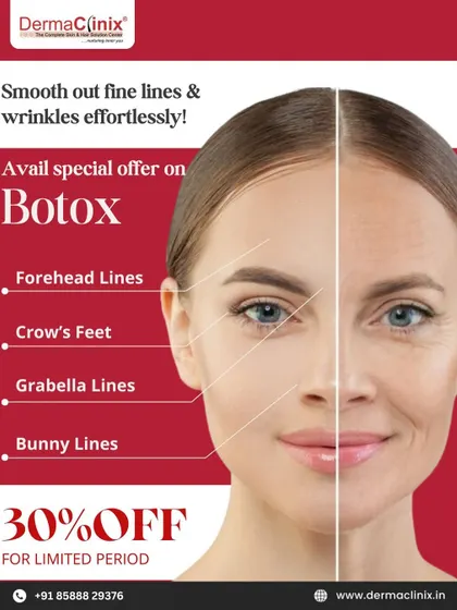 For a limited time, we are offering 30% off on Botox treatments. Smooth out forehead lines, crow's feet, and more for a refreshed appearance.