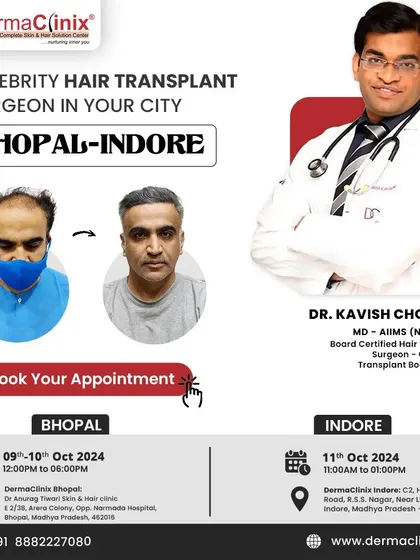 An announcement for my availability for hair transplant consultations in Bhopal and Indore.