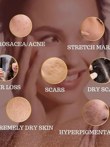 We offer comprehensive solutions for a wide range of skin and hair issues. This visual guide shows some of the common concerns we treat, including hair loss and dry scalp, alongside other conditions like acne and hyperpigmentation.