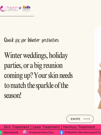 A promotional graphic positioning Skin Boosters as the perfect quick fix for skin ahead of winter festivities like weddings and parties.