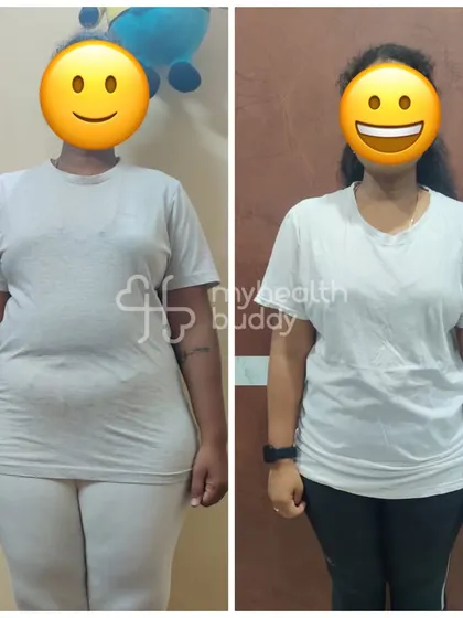 This front view shows the result of consistent effort. My client was so happy to see the lifestyle change and receive compliments on her hard work.