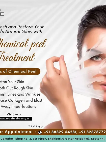 This graphic explains the benefits of a professional chemical peel treatment. It works by gently removing the top layer of dead skin to brighten your complexion, smooth rough skin, and diminish fine lines.