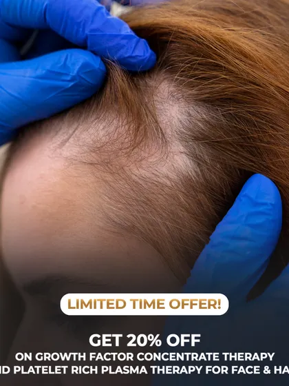 A close-up view of a scalp with visible thinning, a common concern we treat. Our GFC and PRP therapies are designed to target such areas, using your body's own growth factors to promote regrowth.