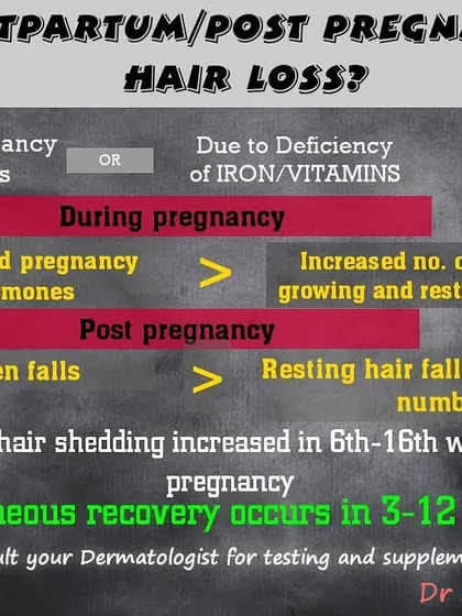 Postpartum hair loss is very common and usually due to hormonal shifts after pregnancy. This graphic explains how estrogen levels affect the hair growth cycle, leading to increased shedding a few weeks after delivery, which typically recovers over several months.