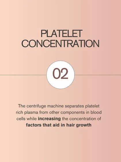 Next is platelet concentration. The centrifuge machine spins the blood sample at high speed, separating the plasma and concentrating the platelets. This process significantly increases the concentration of growth factors that are vital for hair follicle stimulation.