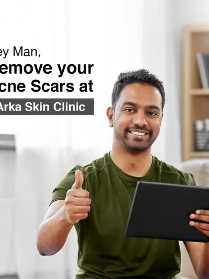 Taking care of your skin is a sign of self-respect. For all the men dealing with acne scars, I offer targeted treatments to help you achieve clear skin and feel your most confident.