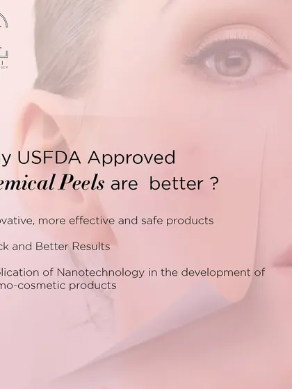 I explain why USFDA-approved chemical peels are better: they are more effective, safer, and use advanced nanotechnology for quick and superior results.