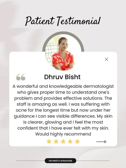 "My skin is clearer, glowing and I feel the most confident that I have ever felt." This is the ultimate goal for every patient. After a long struggle with acne, this patient's visible results are a testament to a guided, effective treatment plan.